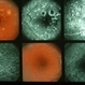 Choroiditis Choroiditis